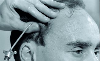L’Homme au crâne rasé